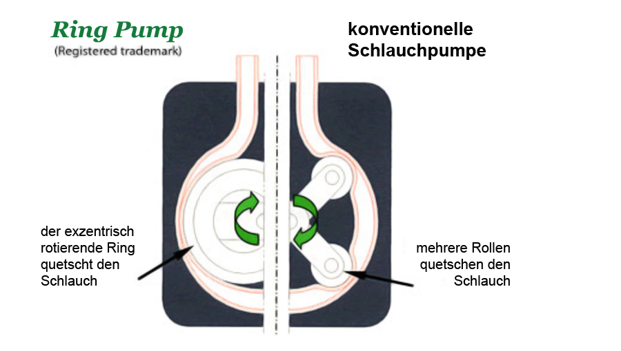 Schlauchpumpen Vergleich Ring Pump